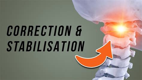 ATLAS Misalignment // Upper Cervical Instability Exercises | Cervical ...