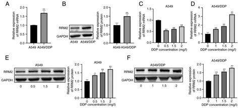 RRM2mediated Wnt βcatenin signaling pathway activation in lung