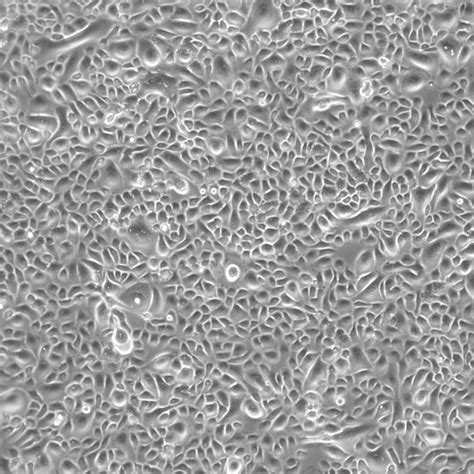 Lobar Bronchial Epithelial Cells Secondary CellSystems