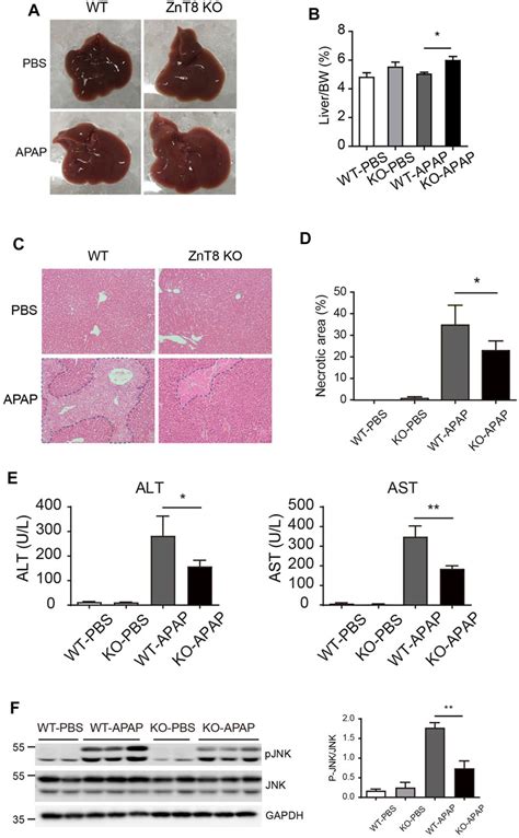 Frontiers ZnT8 Deficiency Protects From APAP Induced Acute Liver