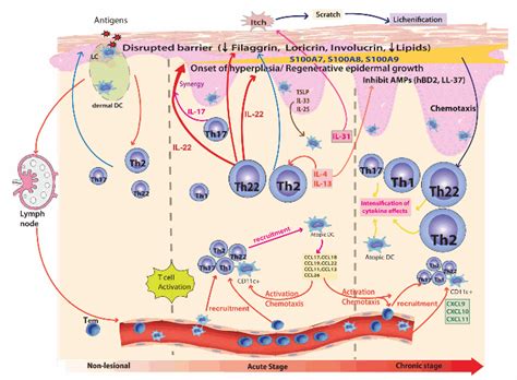 Atopic Dermatitis Pathway