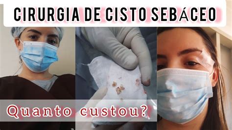 Minha Cirurgia Do Cisto Seb Ceo O P S Operat Rio Youtube