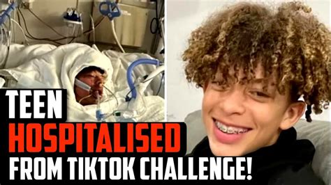 Teen Hospitalised After Tiktok Challenge Leaves Him Covered In Burns