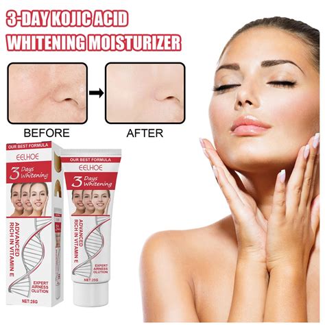 Tu Collagen Whitening Freckle Cream Effectively Remove Melasma Serum