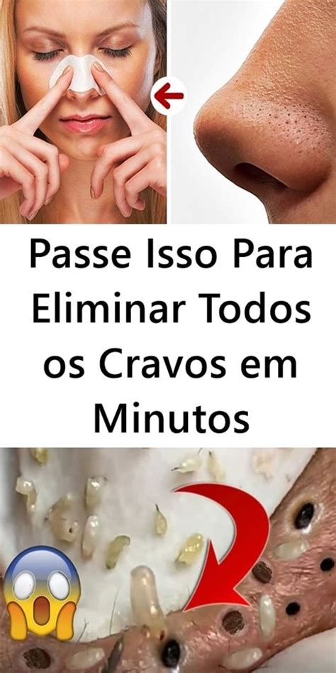 Passe Isso No Nariz Para Eliminar Todos Os Cravos Em Minutos Tirando