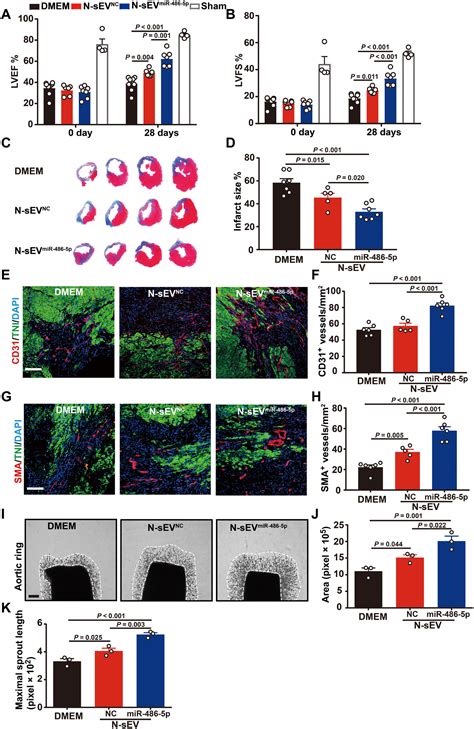 Small Extracellular Vesicles Containing Mir 486 5p Promote Angiogenesis After Myocardial