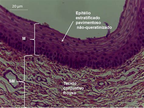 Epitelio Estratificado Pavimentoso Nao Queratinizado