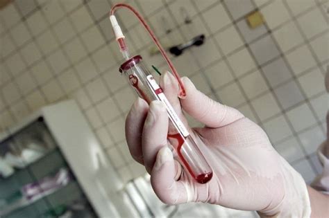 Doh Logs 1347 Hiv Cases In September