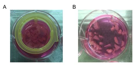 The Ex Vivo Colon Organ Culture And Its Use In Antimicrobial Host