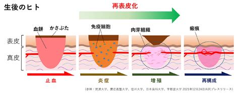 最新研究情報の紹介 イモリのほぼ完全な皮膚再生メカニズムを解明 NPO法人血管医学研究推進機構