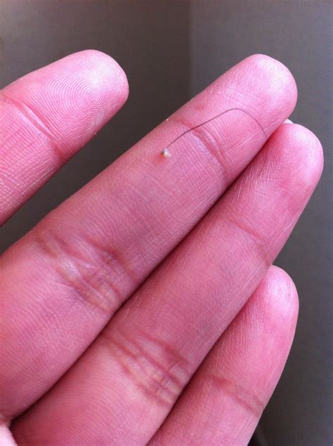 Felt completely satisfied when this ingrown hair came out of my bikini