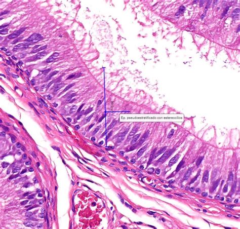 Epitelios De Revestimiento Laboratorio De Biología Interactiva
