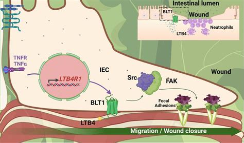 JCI Insight Intestinal Epithelial BLT1 Promotes Mucosal Repair