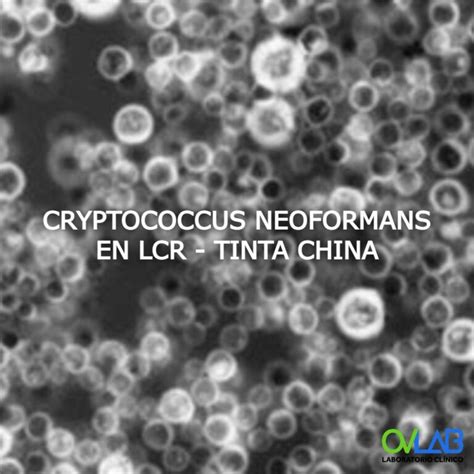 CRYPTOCOCCUS NEOFORMANS EN LCR TINTA CHINA OVLAB O V Laboratorios