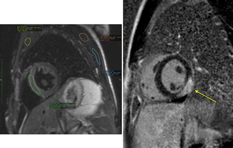 Society For Cardiovascular Magnetic Resonance European Society Of