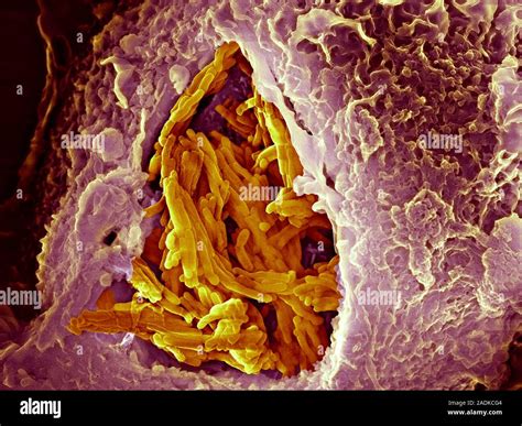 Macrophage Engulfing Tuberculosis Vaccine Coloured Scanning Electron