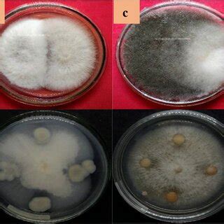 Interaction Mechanism Of Endophytic Fungi Above And Bacteria Below