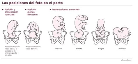 Crecimiento del útero y posturas del bebé para nacer Ecografia 4D y