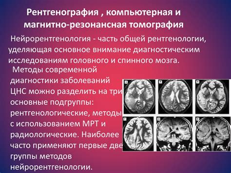 Методы диагностики в неврологии презентация - 85 фото