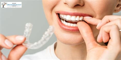 Transforming Your Smile With Dental Appliances Success Stories And Expert Insights