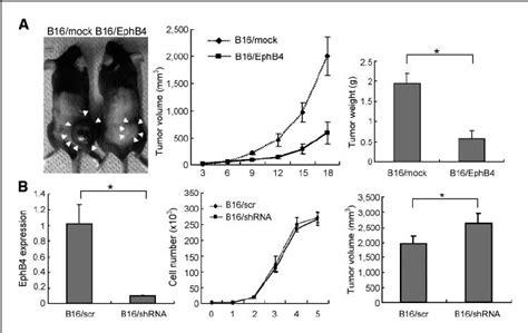 Tumor Growth In Inverse Proportion To The Expression Levels Of Ephb4 Download Scientific