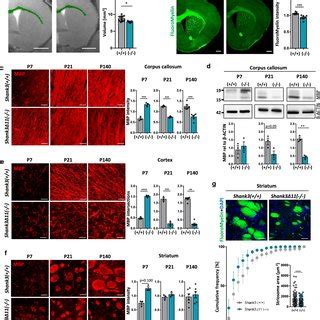 White Matter And MBP Expression Are Changed In The Brain Of