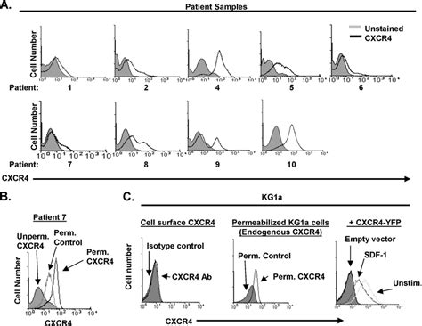 CXCR4 Is Expressed At Variable Levels On AML Cells A Bone Marrow