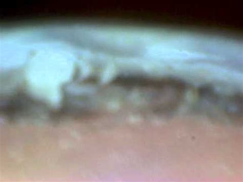 Under The Microscope - The Dirty Fingernail - YouTube