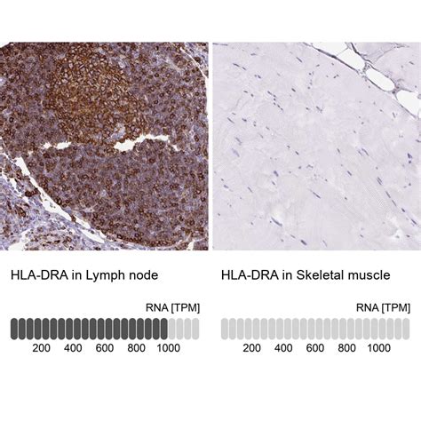 Hla Dra Antibody Pa5 111368