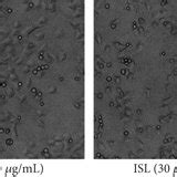 Isoliquiritigenin Induces Apoptosis In A375 Melanoma Cells A Cell