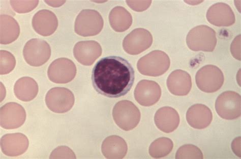 Lymphocytes What They Are And What They Do