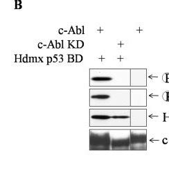 C Abl Phosphorylates Hdmx On Tyr And Tyr In Vivo A Hek Cells