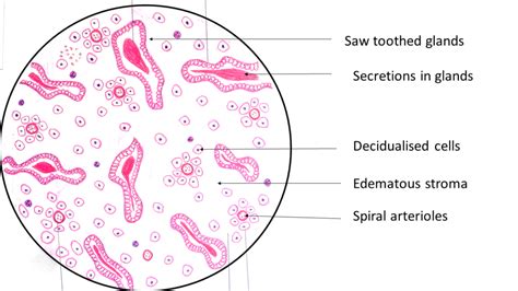 Endometrium: Secretory phase - Pathology Made Simple