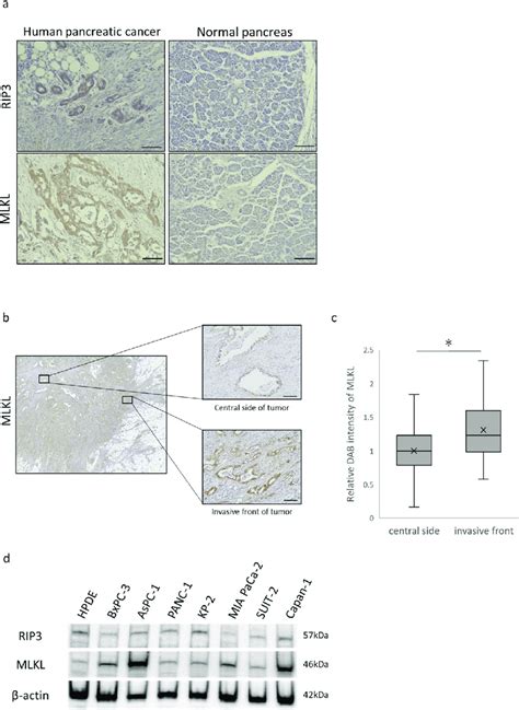 Detection Of Rip And Mlkl Key Mediators Of Necroptosis In Human