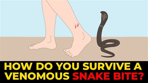 How To Survive Snake Bites Youtube