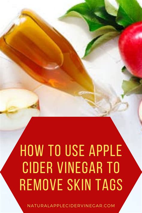 How To Use Apple Cider Vinegar To Remove Skin Tags In Recipe