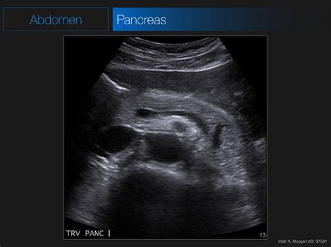 Radiology Quiz 40672 Radiopaedia Org Playlist Anatomy 2017