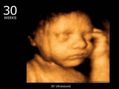 Third Trimester Baby Ultrasound Pictures Weeks 26 40 Pregnancy