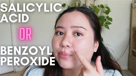 Salicylic Acid Vs Benzoyl Peroxide For Acne Which Is Better 🤔 Youtube