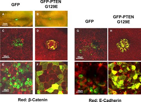 PtdIns 3 4 5 P3 Dependent And Independent Roles For PTEN In The