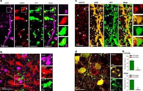Sex Specific Transcriptional Signatures In Human Depression Pmc
