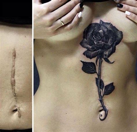 21 Pessoas Que Aproveitaram Suas Cicatrizes Para Fazer Tatuagens