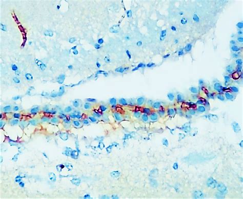 Lamp Antibody Lysosome Marker Ir Ireal Biotechnology Inc