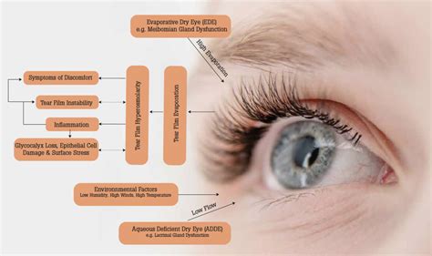 Ocular Surface Diseases Encompass A Range Of Pathologies Involving The