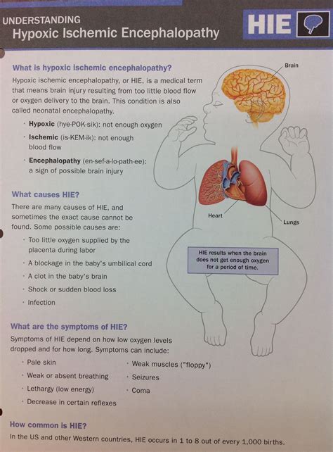 Understanding Hypoxic Ischemic Encephalopathy What Knowledge Askquestions Neonatal Nurse