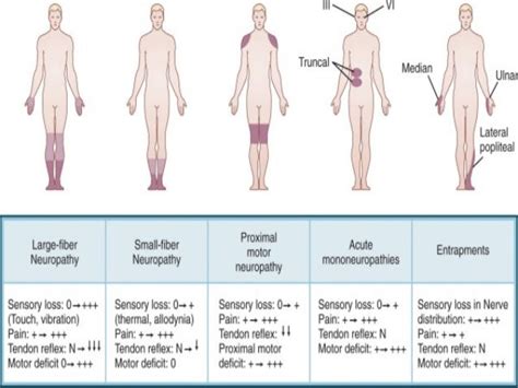 Diabetic POLYNEUROPATHY