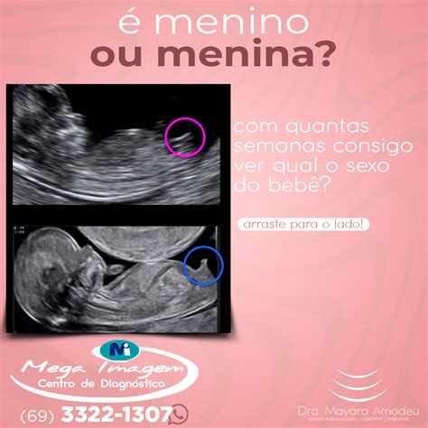 Piu Piu é Menina Ou Menino - 7