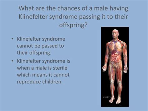 Ppt Klinefelter Syndrome Powerpoint Presentation Id6730570