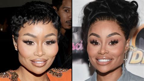 Blac Chyna Posts Face Transformation Video After Dissolving All Her Fillers Capital