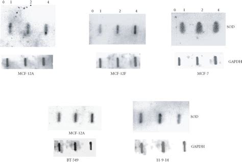 Slot blot hybridization Increasing amounts of RNA 0 1 2 and 4 μg